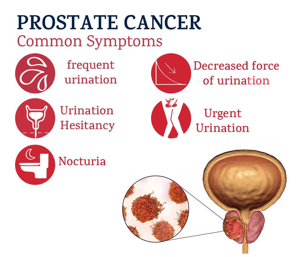 Prostate Cancer Treatment In Punjab Prostate Cancer Treatment Cost In ...